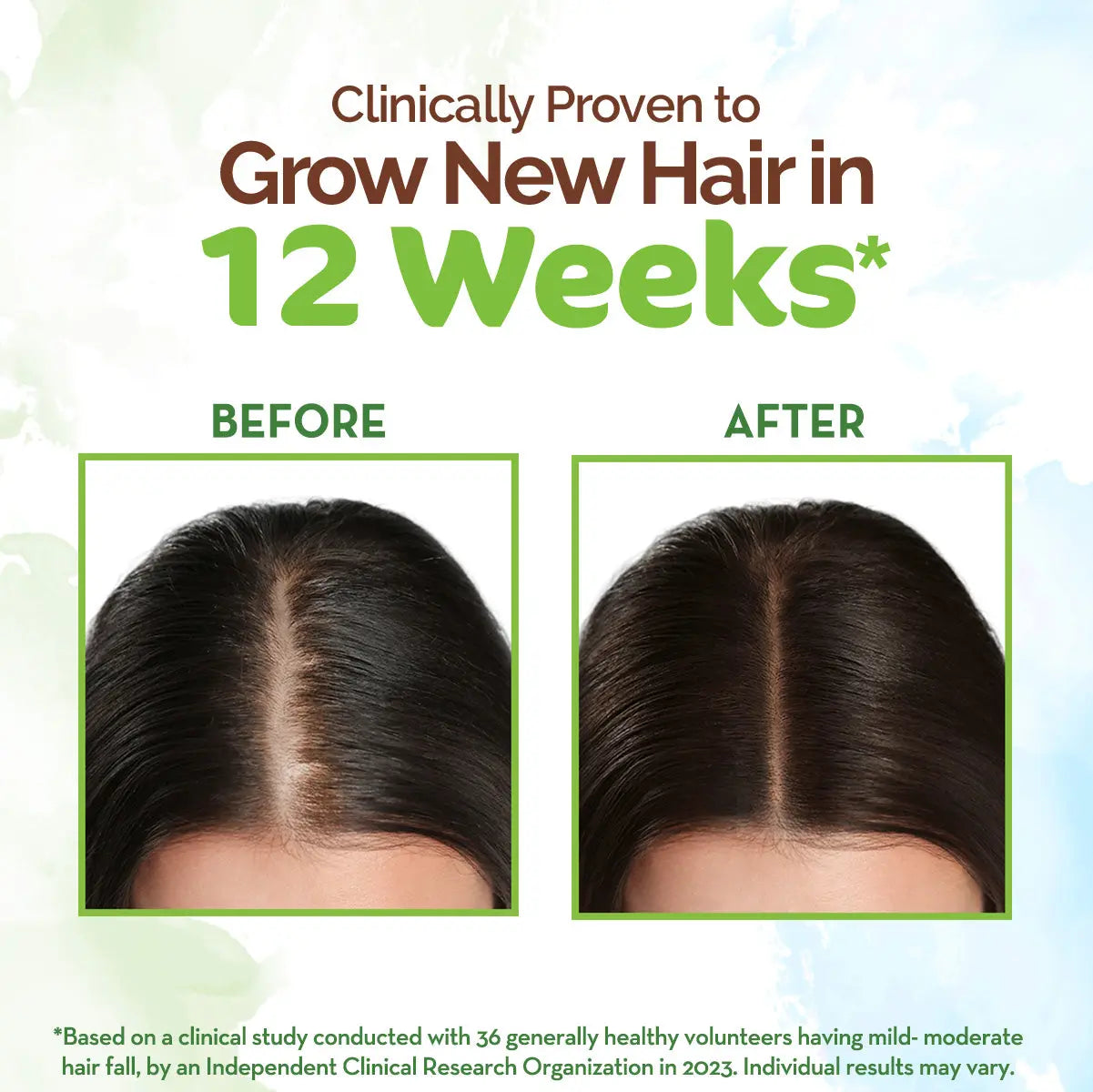 Mamaearth Rosemary Oil For Hair Growth