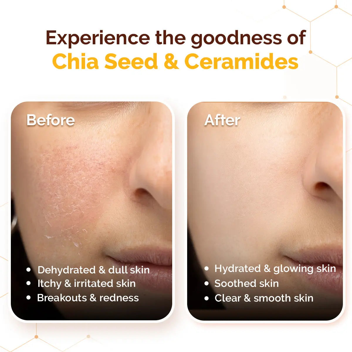 Chia Calming Sunscreen